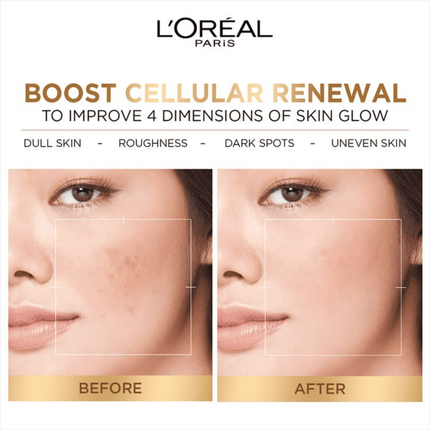 L'Oreal Paris advertisement showing before and after effects of skin improvement.